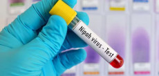 NIH Issues Advisory on Potential Nipah Virus Risk in Pakistan