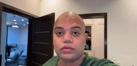 Ducky Bhai‘s Fan Shaved Head To Prove Herself A True Fan