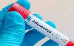 'Adenovirus': New Virus Emerges In Karachi Due To Changing Weather