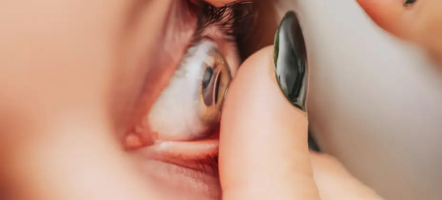 Doctors Uncover 5 Missing Contact Lenses Hidden Behind Woman’s Eyeball