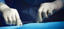 Man Deceived by Job Offer Falls Victim to Kidney Trafficking Ring