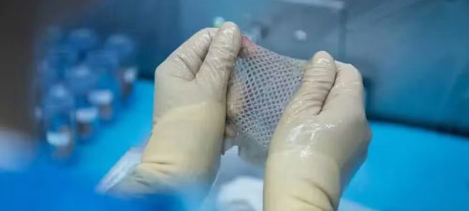 Islamabad’s Renowned Hospital Opens Pakistan’s First Skin Bank For Burn Patients