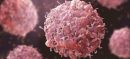 Pakistan Opens First Cancer Treatment Centre Offering 60-Minute Therapy