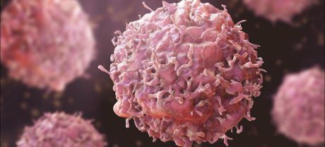 Pakistan Opens First Cancer Treatment Centre Offering 60-Minute Therapy