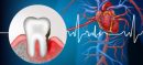 Oral Bacteria Raise Heart Disease Risk, Study Finds