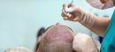 Dubai Police Shuts Down Unauthorized Hair Transplant Clinic