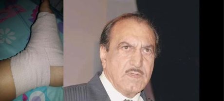 Actor Mustafa Qureshi Injured After Fall on Broken Karachi Road