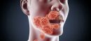 Silent Mouth Threat: Recognize Oral Cancer Warning Signs