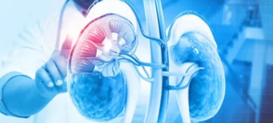 Historic Kidney Procedure Makes Blood Group Compatibility Possible