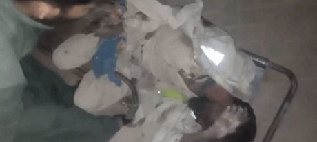 Hyderabad Civil Hospital Doctors Refuse Treatment Over Patient’s Foul Odor