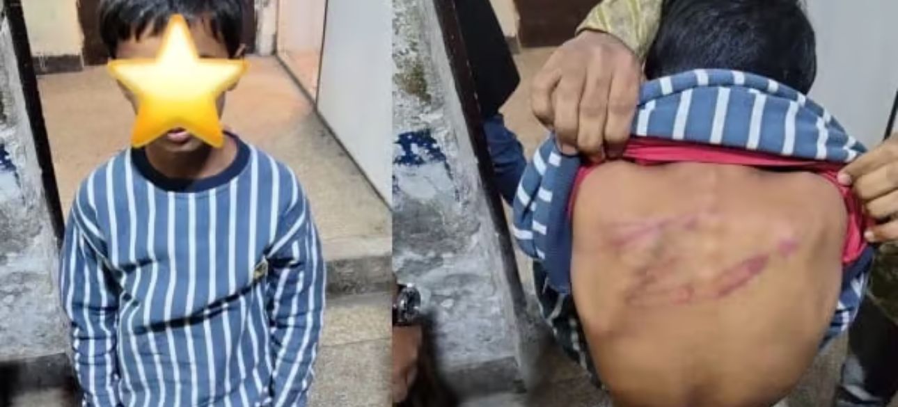 Lahore Teacher Held for Severely Assaulting Student over Missed Lesson