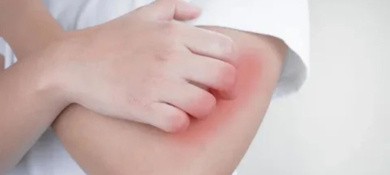 Stop Guessing As Dermatologists Explain Dry Skin And Eczema Stop Guessing As Dermatologists Explain Dry Skin And Eczema