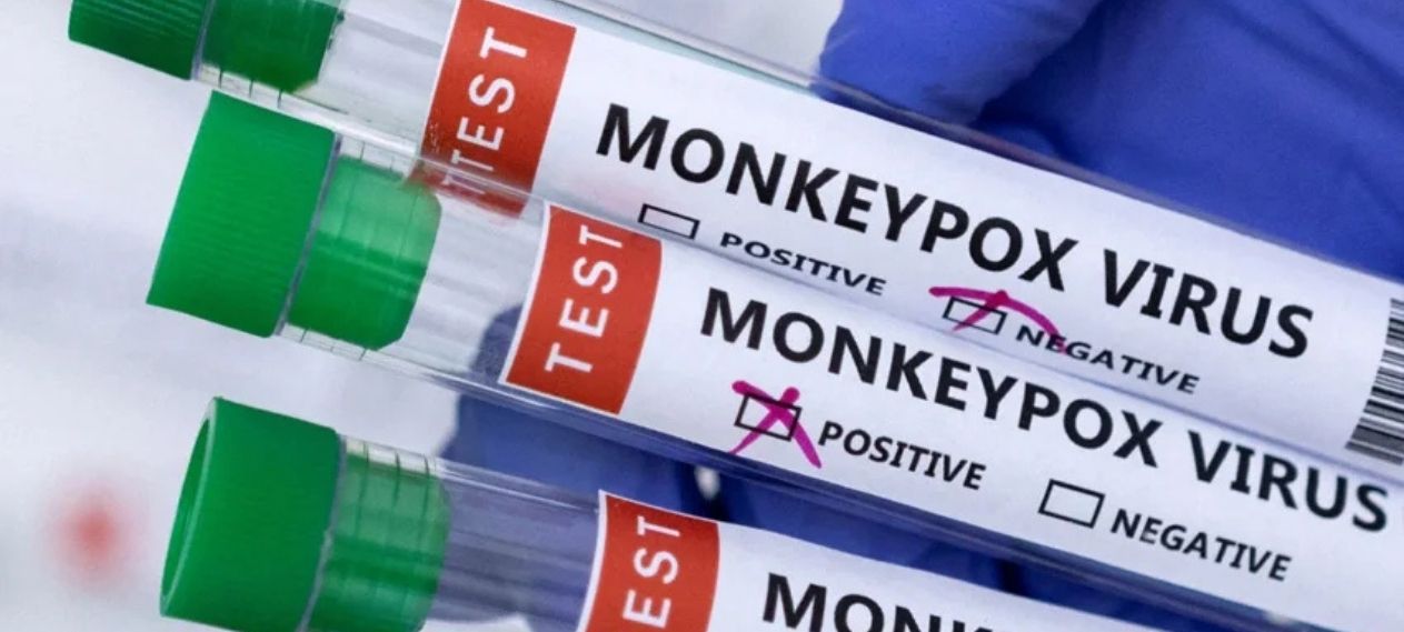 Health Officials Confirm Two New Mpox Cases, Urge Caution Health Officials Confirm Two New Mpox Cases, Urge Caution