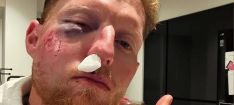 Surgery Keeps Ben Stokes Out of Early County Fixtures