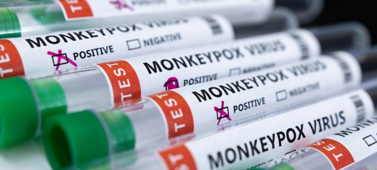 Two New Monkeypox Cases Reported in Lahore Amid Rising Numbers