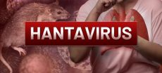 Hantavirus Explained: Symptoms, Transmission and Safety Measures
