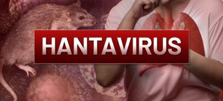Hantavirus Explained: Symptoms, Transmission and Safety Measures