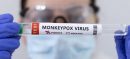 Karachi Reports Another Confirmed Case of MPox