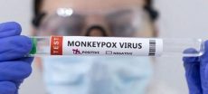 Karachi Reports Another Confirmed Case of MPox