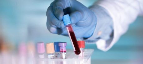 Scientists Discover Blood Test That Could Predict Lung Cancer