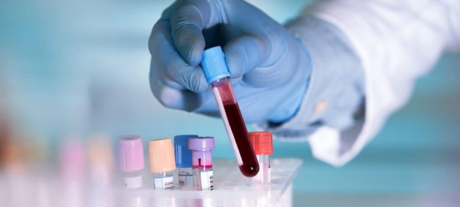 Scientists Discover Blood Test That Could Predict Lung Cancer