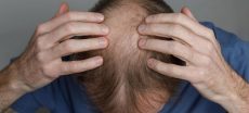 Scientists Explore Ancient Plant as New Hair Loss Treatment