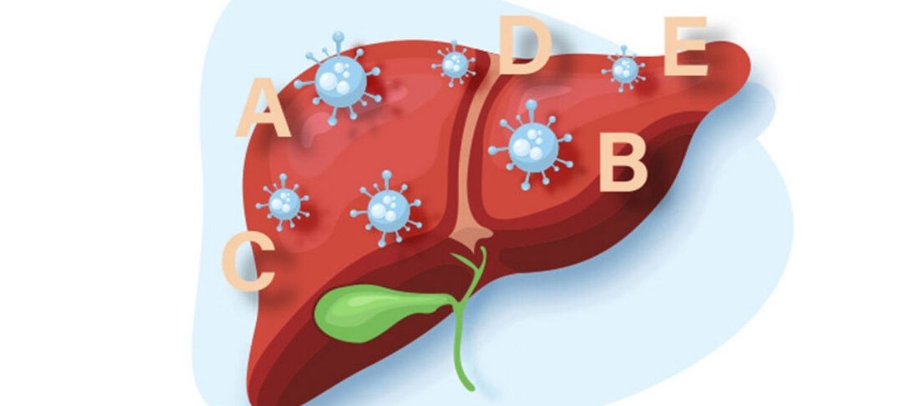 Pakistan Ranks Fifth Worldwide for Viral Hepatitis Burden Pakistan Ranks Fifth Worldwide for Viral Hepatitis Burden