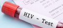 Sindh Plans FIRs Against Doctors Over Rising HIV Cases