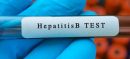 Hepatitis Tests Begins for Government Employees