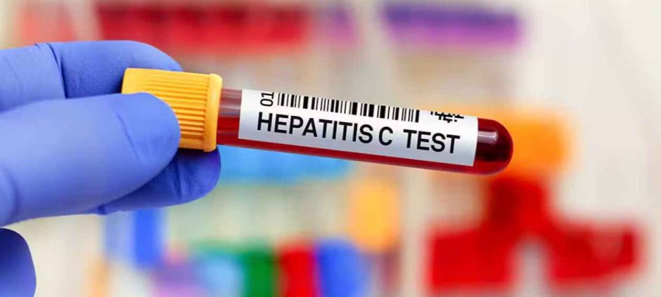 Pakistan Expands Hepatitis C Screening Across the Country