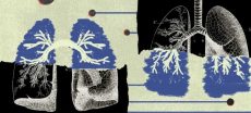 13 Lung Cancer Myths Experts Say You Should Stop Believing