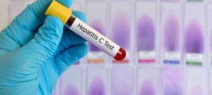 Islamabad Expands Free Hepatitis C Screening and Treatment