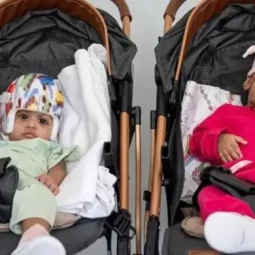 Pakistani Conjoined Twins Successfully Separated in 14-Hour Surgery in Türkiye